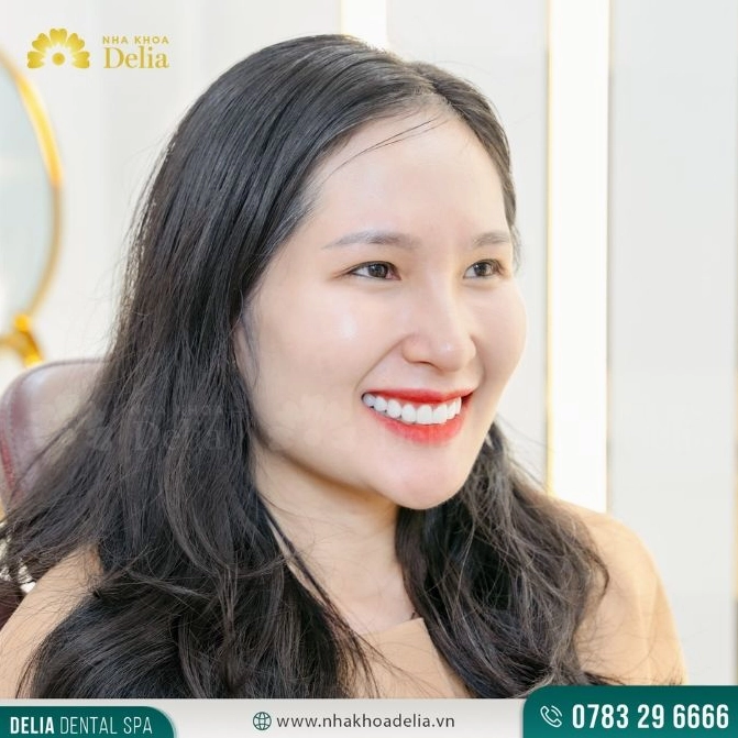 Hình ảnh giải thích khái niệm chụp ảnh tự sướng là gì một cách trực quan