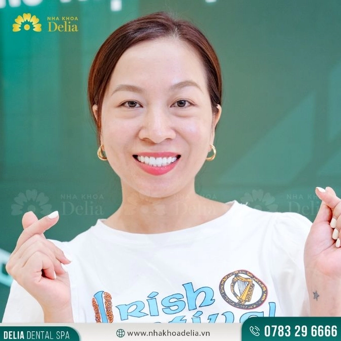 Minh họa chi tiết về việc chụp ảnh tự sướng là gì trong thời đại số