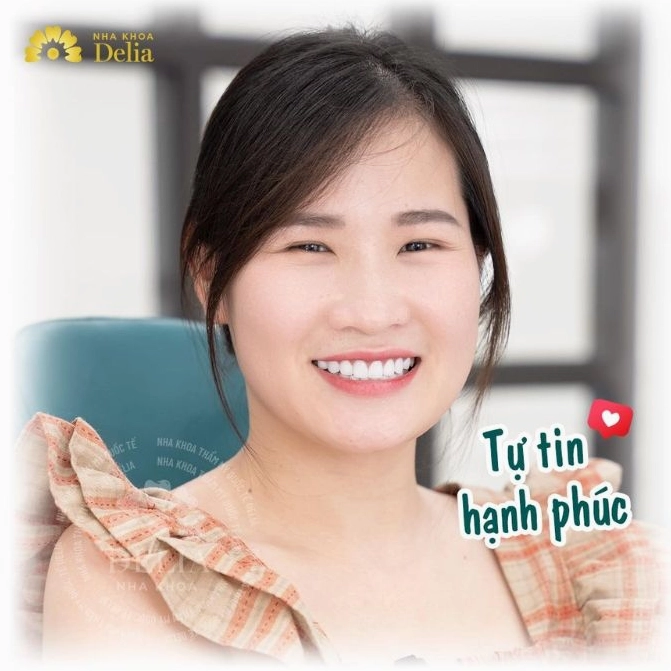 Tuyệt chiêu chụp ảnh selfie đẹp thu hút mọi ánh nhìn