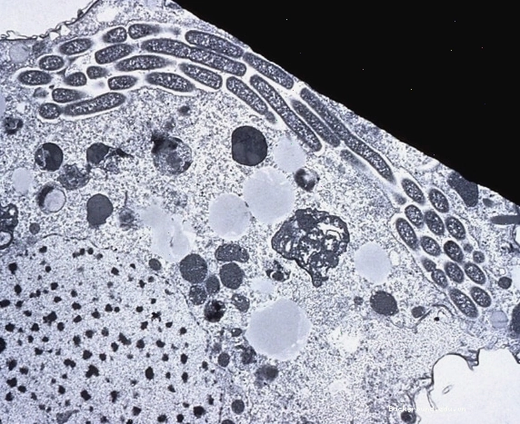 Cận cảnh vi khuẩn Legionella Pneumophila nội bào